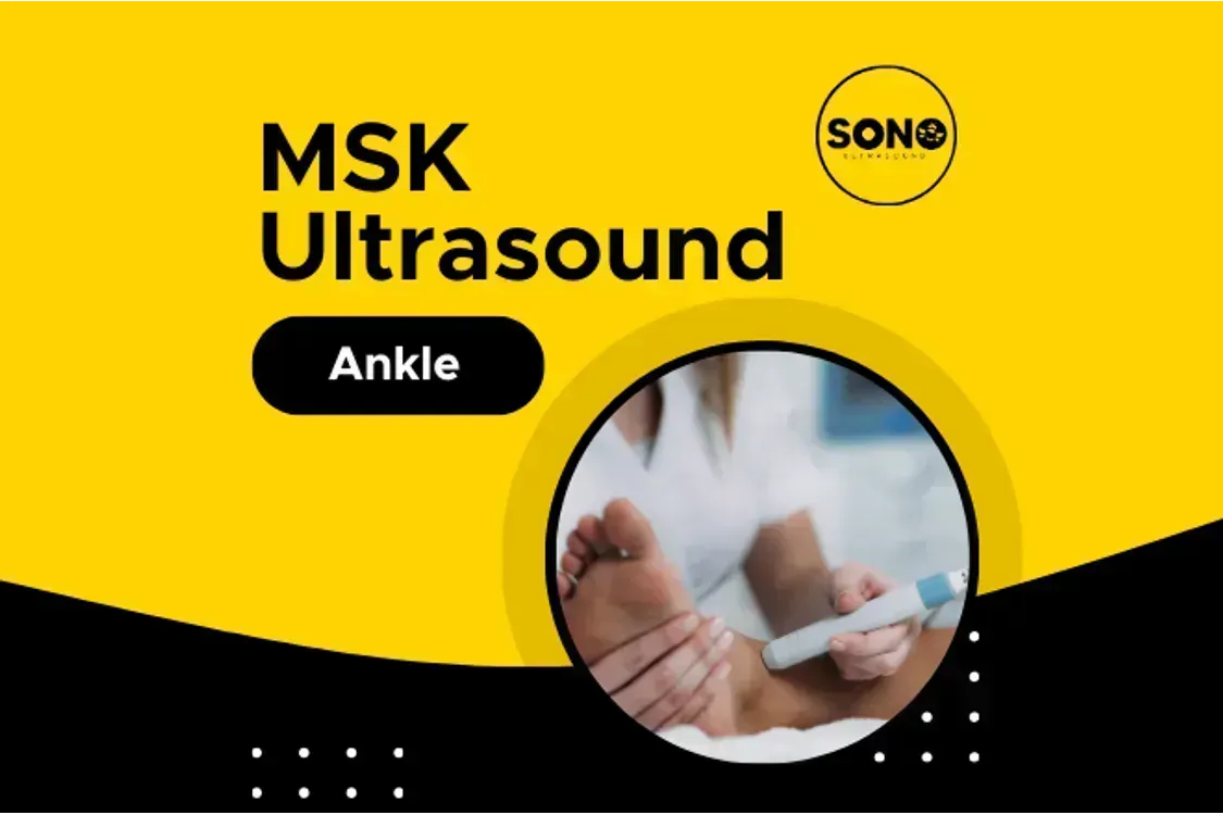 Ankle MSK Scan